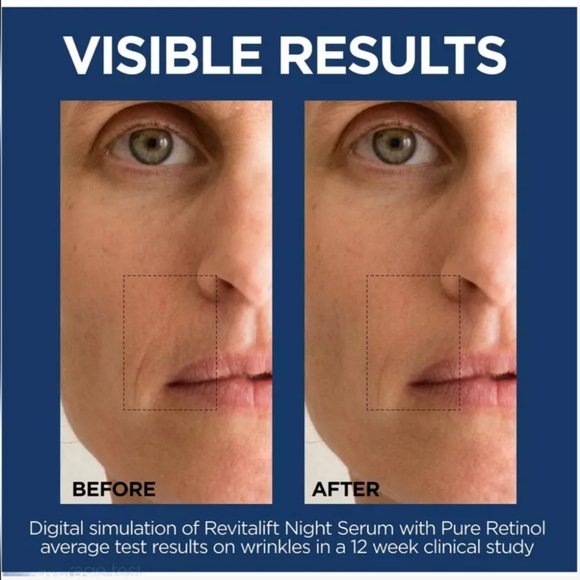 COPY - L'Oreal Revitalift W/ Retinol Serum+Pressed Night Cream Bundle, $25! - Picture 4 of 8